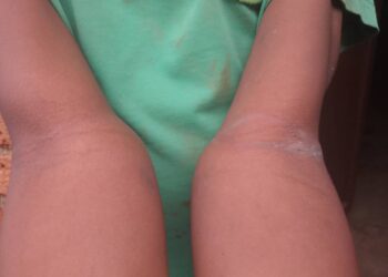 Insécurité à Bukavu: un enfant séquestré par des jeunes à Cimpunda